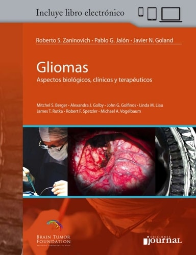 Gliomas: Aspectos biológicos, clínicos y terapéuticos