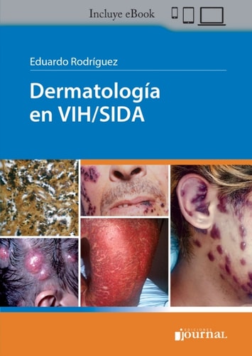 Dermatología en VIH/Sida