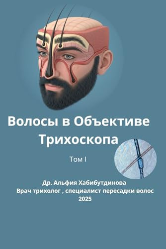 Волосы в Объективе Трихоскопа: Современные методы трихоскопии (Ukrainian Edition)