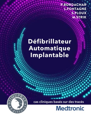 Défibrillateur Automatique Implantable: Cas cliniques basés sur des tracés Medtronic (French Edition)