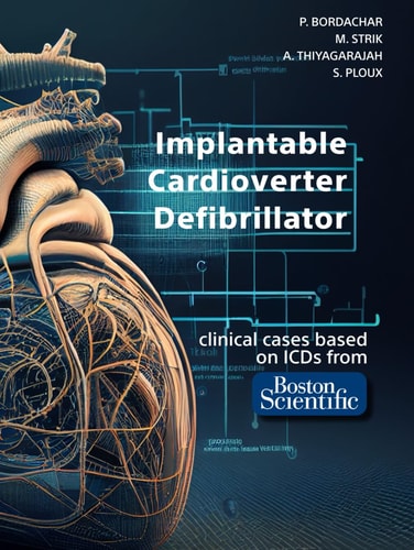 Implantable Cardioverter Defibrillator: based on clinical cases from Boston Scientific ICDs