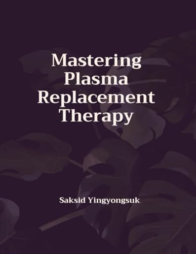 Mastering Plasma Replacement Therapy