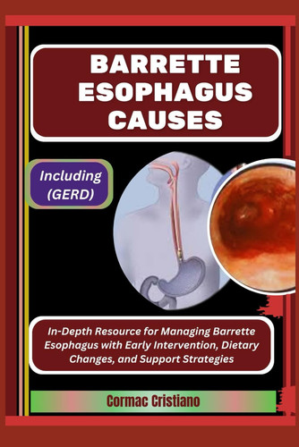 Barrette Esophagus Causes - Including (GERD): In-Depth Resource for Managing Barrette Esophagus with Early Intervention, Dietary Changes, and Support Strategies