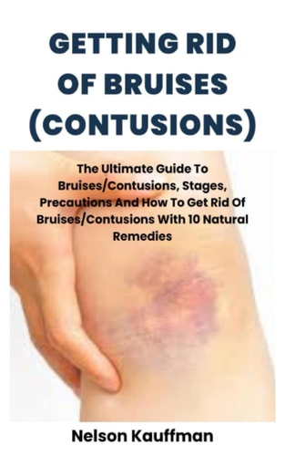 GETTING RID OF BRUISES (CONTUSIONS): The Ultimate Guide To Bruises/Contusions, Stages, Precautions And How To Get Rid Of Bruises/Contusions With 10 Natural Remedies