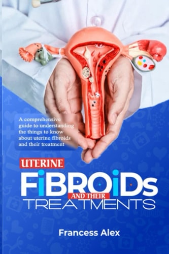 UTERINE FIBROIDS AND THEIR TREATMENT: A comprehensive guide to understanding the things to know about uterine fibroids and their treatment
