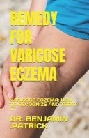 Remedy for Varicose Eczema - Varicose Eczema: How to Recognize and Treat It