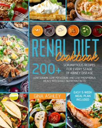 Renal Diet Cookbook: 200+ Scrumptious Recipes for Every Stage of Kidney Disease. Low Sodium, Low Potassium and Low Phosphorus Meals with Exact Nutrition Facts. Easy 5-Week Meal Plan Included