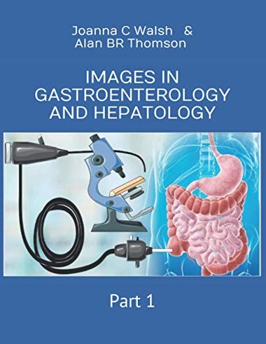 IMAGES IN GASTROENTEROLOGY AND HEPATOLOGY PART 1