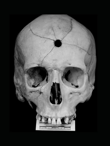 Antropologia: Mentes Criminosas e a Psicopatologia (Portuguese Edition)