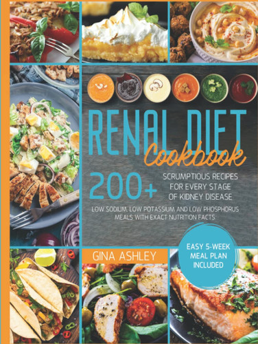 Renal Diet Cookbook: 200+ Scrumptious Recipes for Every Stage of Kidney Disease. Low Sodium, Low Potassium and Low Phosphorus Meals with Exact Nutrition Facts. Easy 5-Week Meal Plan Included