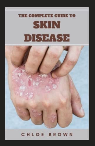 THE COMPLETE GUIDE TO SKIN DISEASE: The Effective Truth about Vitamin D, Sensible Sun Exposure and Skin Cancer