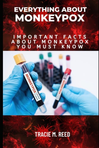 EVERYTHING ABOUT MONKEYPOX: Important facts about Monkeypox you must know.
