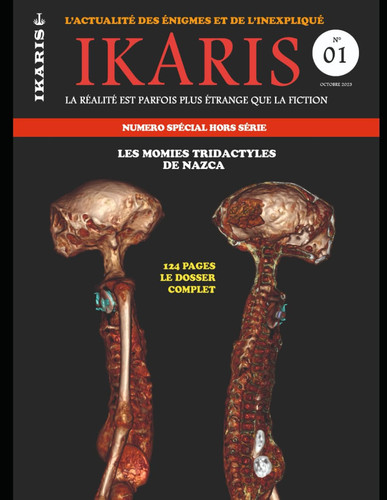 La véritable histoire des momies à trois doigts découvertes au Pérou: L'intégralité de l'histoire avec toutes les analyses ADN, les scanners et les ... (IKARIS MAGAZINE HORS SERIE) (French Edition)
