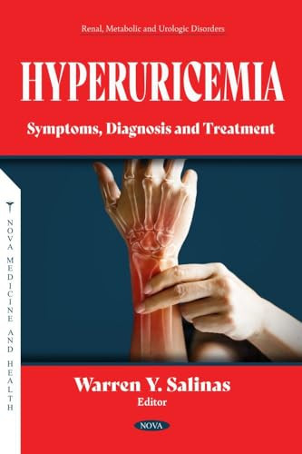 Hyperuricemia Symptoms, Diagnosis and Treatment