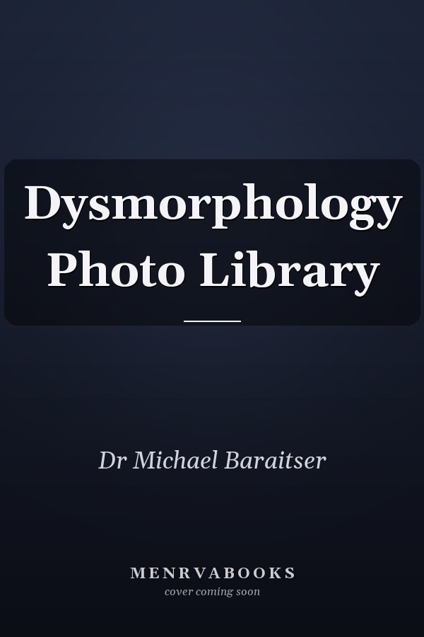 Dysmorphology Photo Library