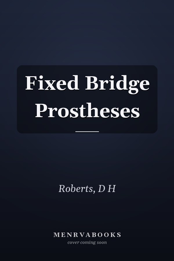 Fixed Bridge Prostheses