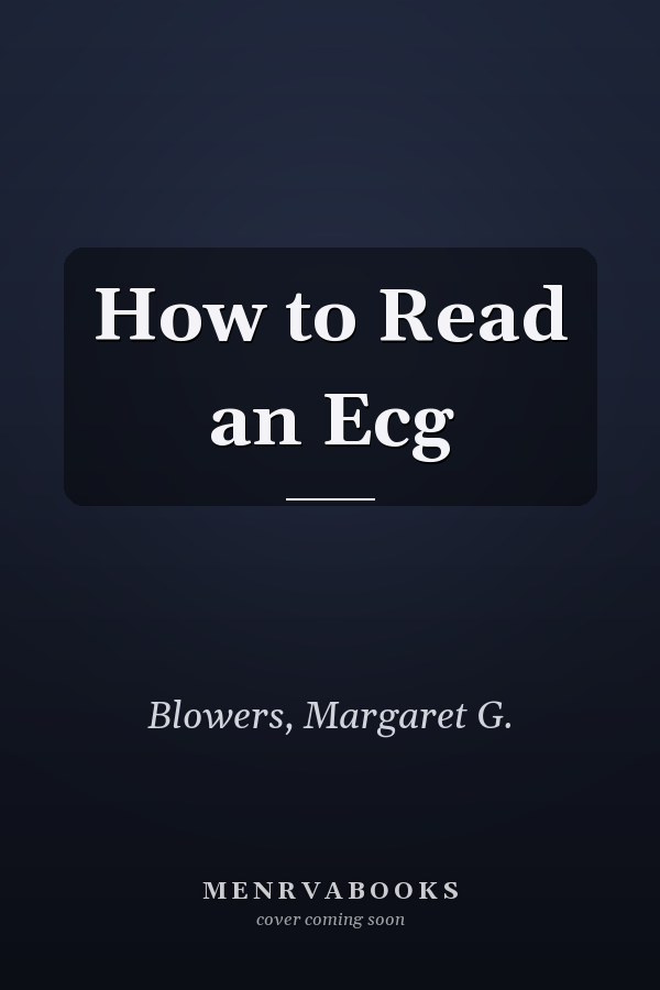 How to Read an Ecg