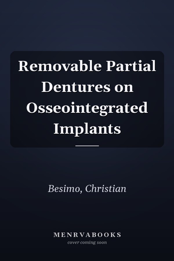 Removable Partial Dentures on Osseointegrated Implants