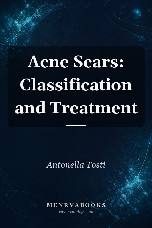 Acne Scars: Classification and Treatment