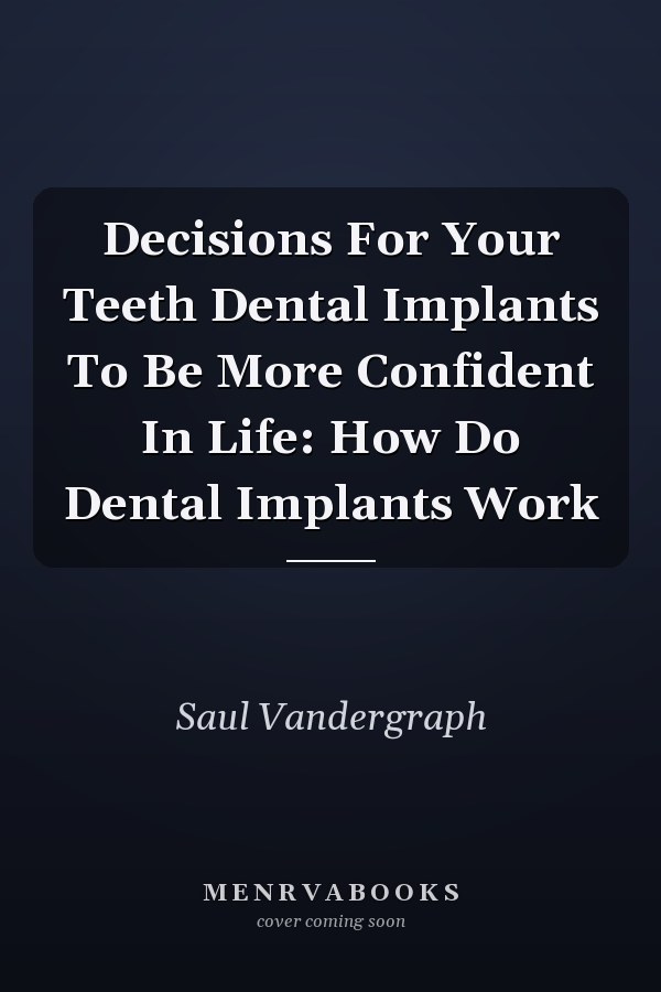 Decisions For Your Teeth Dental Implants To Be More Confident In Life: How Do Dental Implants Work