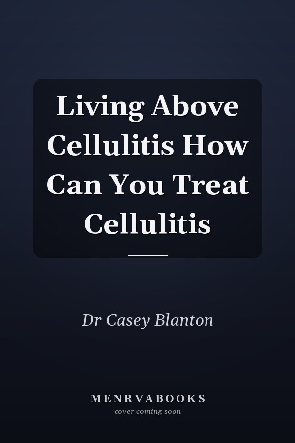 Living Above Cellulitis How Can You Treat Cellulitis