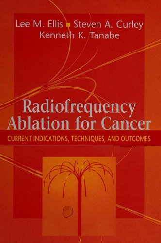 Radiofrequency Ablation for Cancer