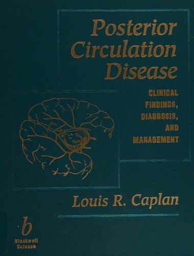 Posterior circulation disease
