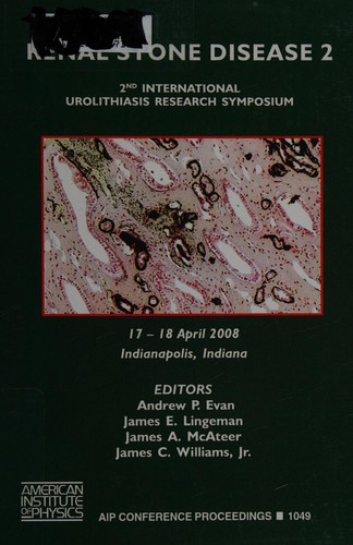 Renal Stone Disease 2