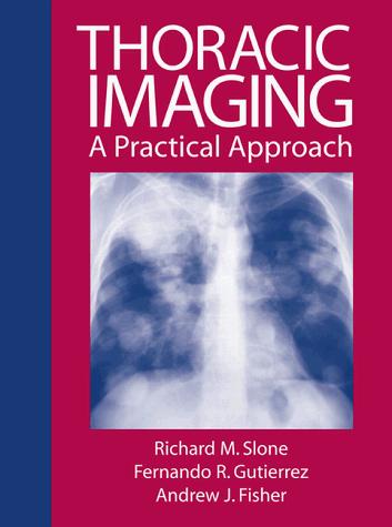 Thoracic Imaging