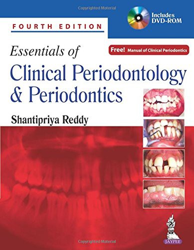 Essentials of Clinical Periodontology and Periodontics