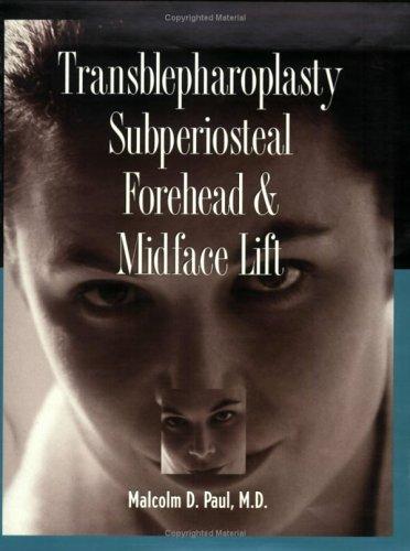 Transblepharoplasty Subperiosteal Forehead & Midface Lift