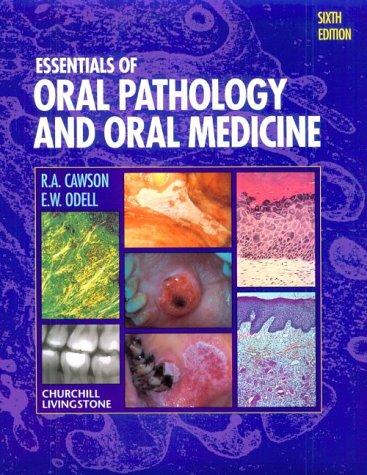 Essentials of oral pathology and oral medicine