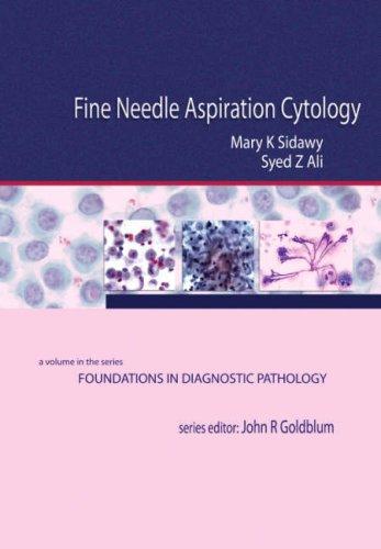 Fine Needle Aspiration Cytology