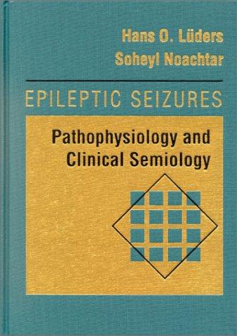Epileptic Seizures