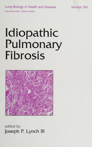 Idiopathic Pulmonary Fibrosis