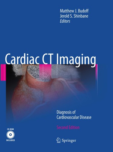 Cardiac CT Imaging