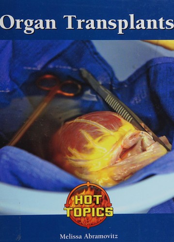 Organ transplants