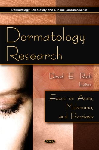 Dermatology Research Focus on Acne, Melanoma, and Psoriasis