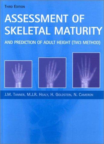 Assessment of Skeletal Maturity and Prediction of Adult Height (TW3 Method)