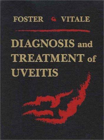 Diagnosis and Treatment of Uveitis