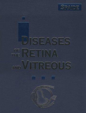 Diseases of the Retina and Vitreous
