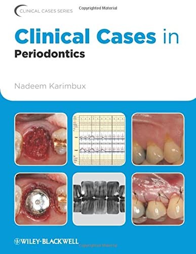 Clinical cases in periodontics