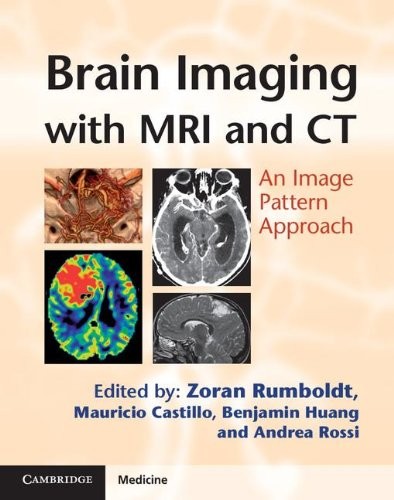 Brain imaging with MRI and CT