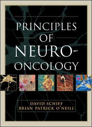 Principles of neuro-oncology