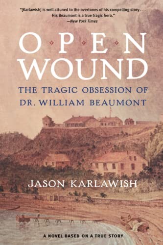 Open wound
