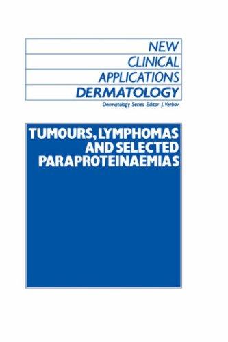 Tumours, Lymphomas, and Selected Paraproteinaemias