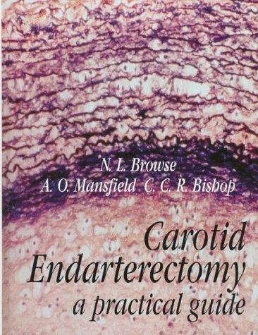 Carotid Endarterectomy