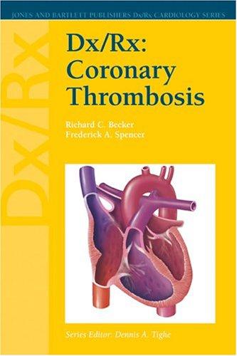 Dx/Rx Coronary Thrombosis (Dx/Rx Cardiology Series)