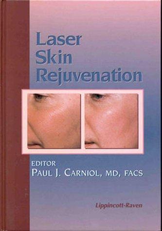 Laser skin rejuvenation
