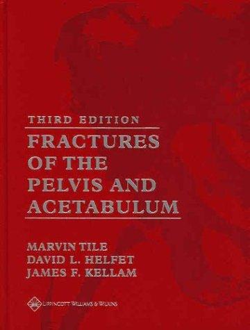 Fractures of the Pelvis and Acetabulum